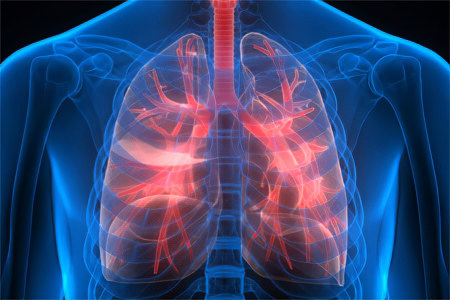 2 заболевания с похожими симптомами на пневмонию